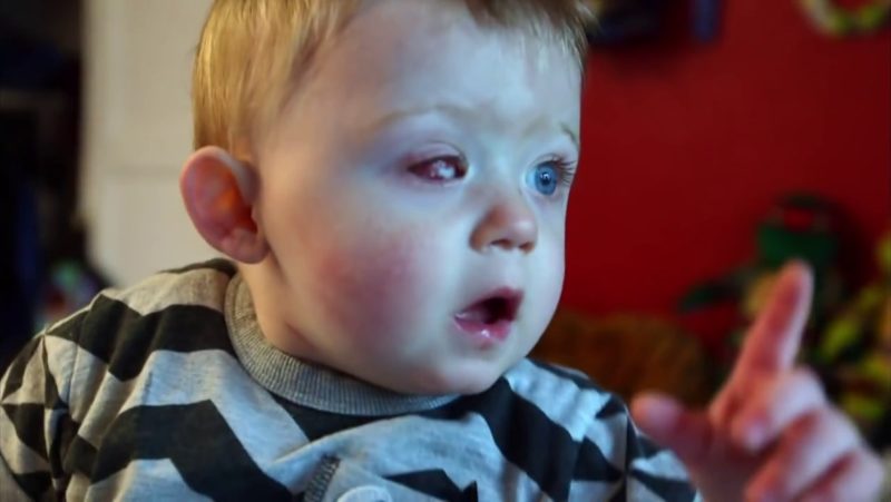 幼童 Oscar Webb 右眼無法救治，現已移除，需要裝上義眼。
