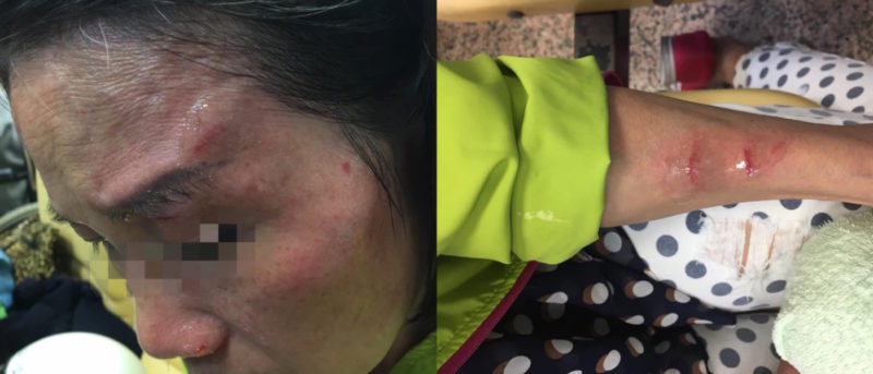 台北 寧夏夜市 空拍機 砸傷 婦人